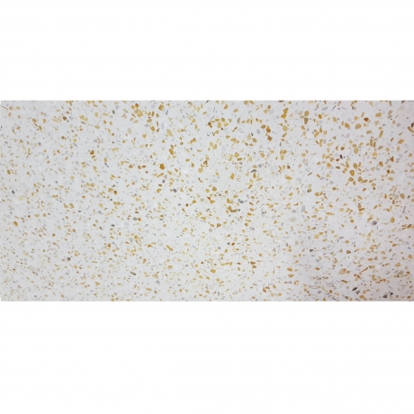 BẬC CẦU THANG TERRAZZO TS1-09S